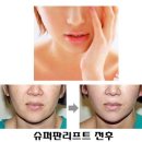 V라인S라인