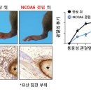 관절에 요산 쌓이는 ‘통풍성 관절염’, 강력한 유발인자 찾았다 이미지