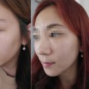 플레인의원
