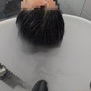 모락스칼프 이미지