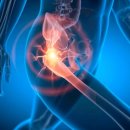 삼성본튼튼의원 이미지