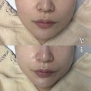 우리생협(연산점) | 연산동 피부관리 르블랑스킨 LDM물방울초음파 탄력 관리 후기