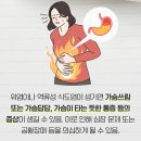 가슴이 쓰리고 타는 듯한 통증 이미지