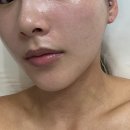 블라썸 에스테틱 - 안산시 단원구 | 용인피부관리 비대칭 이중턱고민 더블라썸 에스테틱 솔직후기