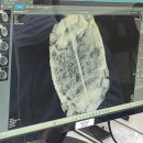 리틀버드서울 버드앤주클리닉 이미지