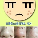 아그네스 이미지