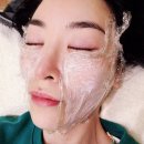 덕천사우나 | 얼굴 탄력과 볼륨 UP! 부산 덕천피부과 쥬베룩볼륨 한 달 리뷰