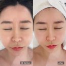 4835 | 연수구에스테틱 안면유지인대수기관리 관리 후기 피아레스테인천송도점