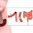대장암 초기증상 방귀 혈변 설사로 알아보는 증상 정리, 20대 위험성 검사 원인 이미지