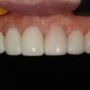 여치과기공소 이미지