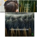 누가의료기서울삼양사거리점 | 장안동붙임머리,장안동붙임머리추천 기술력으로 증명하는 진짜 실력