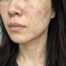 설화수 윤조에센스 순서 6세대 레이어링 기미 잡티 윤광 해결 후기