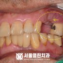 서울아인치과의원 이미지