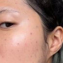 에클로 - 달서구 달구벌대로251길 33 | 리쥬란 맞고 수영 언제해도 될까요? | 리쥬란 2회차 • 리셀에클로 앰플 후기