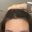 올라뷰티 | [Wedding] 5-1. 올라뷰티 헤어라인 채움 후기(소개이벤트 있어요💕)