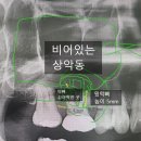 안산의료복지사회적협동조합 새안산우리치과의원 | 안 아프고 돈 아끼는 방법 : 치과 빨리 가기(feat. 새안산우리치과)
