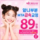 암사동치과 앞니부분 치아교정, 급속교정으로 빠른 심미 개선 가능할까요? 이미지