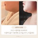 웰메디칼 | 다산 피부관리 이중턱관리, 올V 이중컷팅 조각술 리프팅 후기 미올뷰티