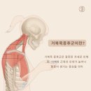 마곡역거북목관리 , 마곡경락, 오브미 - 묵직하고 개운하지 않았는데 목 풀고 나서 달라진 후기