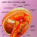 김정선한의원 | 뇌졸중 증상 및 응급조치