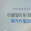 바르다성형외과의원 네이버블로그