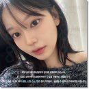 연골 | 코끝 연골묶기 후기 비용 가격 및 회복기간 효과 유지기간 부작용