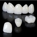 세라믹치과기공소 이미지