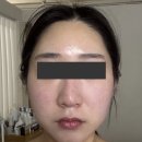 황금역 피부관리샵 추천ㅣ린앤스킨 딥티슈 림프팅 관리 후기