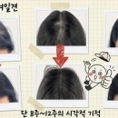 대구탈모관리, 제대로 관리받고 싶다면 마이크로청담대구가 정답!