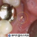 화이트플러스치과 이미지