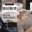 명성뷰티 | 포항 윤곽관리 명성황후 알테온 관리와 플라즈마로 즉각적인 리프팅 효과