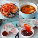 대량구매쟁이 발톱 검은점 빙그레요 일상