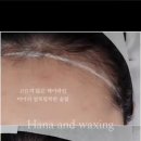 논현고잔동-5 | 하나앤왁싱 인천논현점_페이스왁싱 헤어라인+이마왁싱 남여왁싱