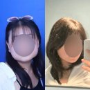 강철병원 | 강철턱의 국산 사각턱 보톡스 2년 동안 5회 맞아본 후기(보상근육, 내성)