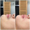 아나덴슈가링왁싱수원영통역점 네이버블로그
