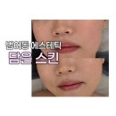 케어로 | 범어동 에스테틱 담은스킨 수분, 장벽 케어로 속건조 잡은 후기
