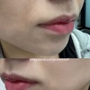 상동약국 | 부천 상동 왁싱 브로우바로 부천상동점 꼼꼼한 눈썹 인중왁싱 솔직후기