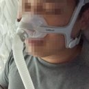 SIM’S 오토클리닉 | 수면무호흡증 양압기 실사용 후기 (+검사방법)