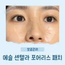 💜모공쫀쫀 리뉴얼템💜 에쎌 센텔라 포어리스 패치 솔직 후기