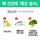 뼈에 좋은 음식 (골다공증) 챙겨야 하는 이유 이미지