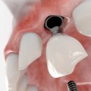 연세이엔박치과의원 이미지