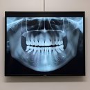 계산청원치과의원 | 갑자기 치과 갈 일 생겨서 찐텐으로 다녀온 후기