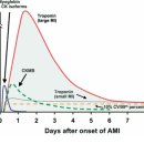 진성ESC | 심근 경색증(Myocardial Infarction)