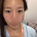 시네마의원 | 논현역 피부과 시네마의원 맞춤 레이저 프리미엄 후기