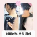 뉴월드헤어라인 | 예비신부 본식 전 풀 페이스왁싱, 뒷목왁싱 후기 - 젠틀앤젠틀 왁싱 강남구청점 본점