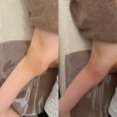 유하 | 광주 팔뚝 슬림관리 후기｜유하에스테틱에서 라인 정리 제대로!