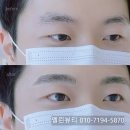 청라큰사랑약국 | 청라남자눈썹문신 처음이라 고민된다면? 실제 고객 후기 공개