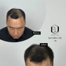 이모션유 이미지