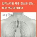 췌장암 조기 진단법 이미지