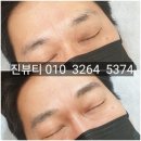 하늘성형외과의원 | 수원 복 들어오는 남자눈썹 자연스럽게 잘 하는 곳(+후기)
